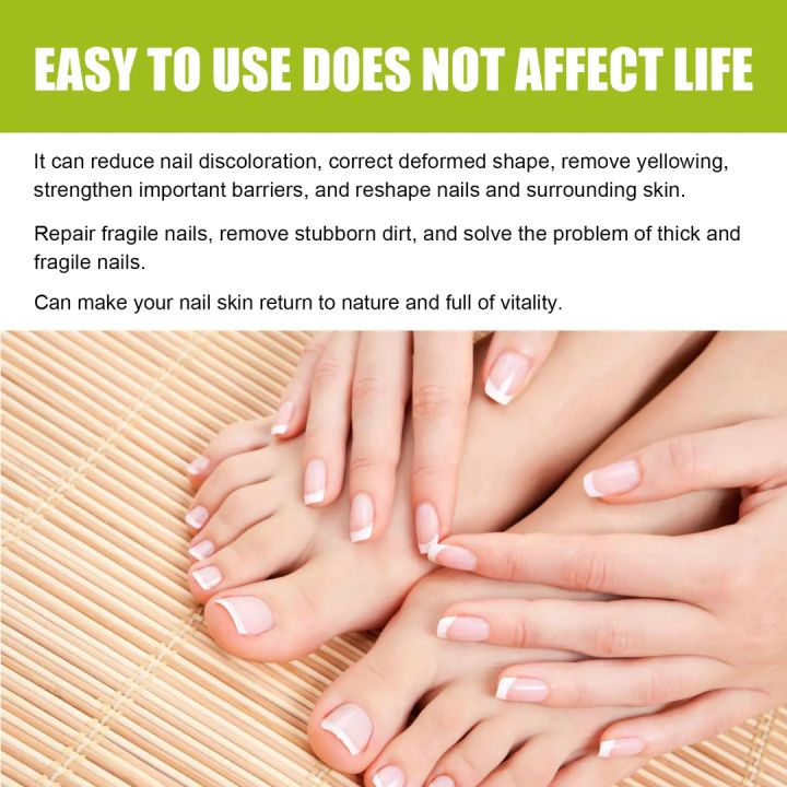 EELHOE%20Nail%20Treatment%20Repair%20Gel%2020g%20-%20Image%204