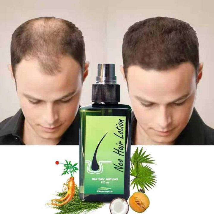 Green%20Wealth%20Neo%20Hair%20Lotion%20Original%20120%20ML%20-%20Image%203