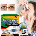 Blueberry Lutein Cataract Treatment Eye Drops Eyesight Improvement Dry Eyes Blurred Vision Glaucoma Presbyopia Removal Medicine. 