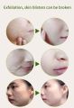Yan Namei Ji Pure Natural Clean Care Pomegranate Peeling Gel Removing Dead Skin Cells, Controlling Sebum, Eliminating Blackheads, Made In P.R.C.