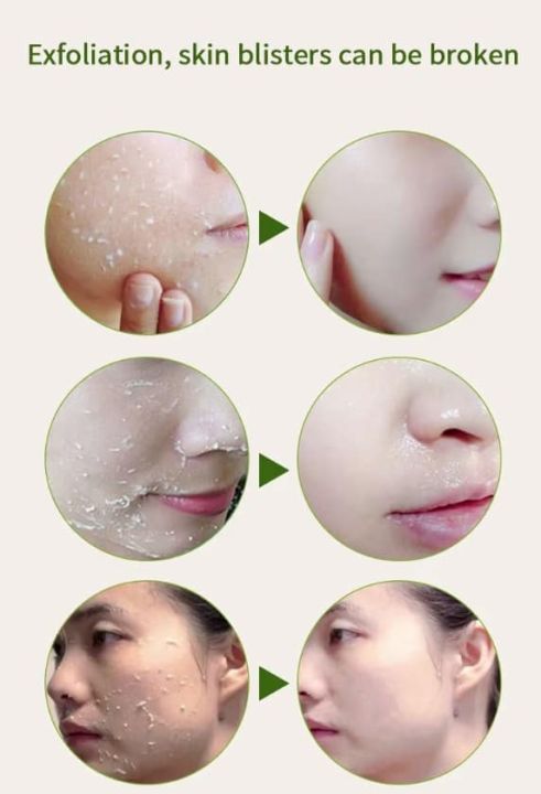 Yan%20Namei%20Ji%20Pure%20Natural%20Clean%20Care%20Pomegranate%20Peeling%20Gel%20Removing%20Dead%20Skin%20Cells,%20Controlling%20Sebum,%20Eliminating%20Blackheads,%20Made%20In%20P.R.C%20-%20Image%202