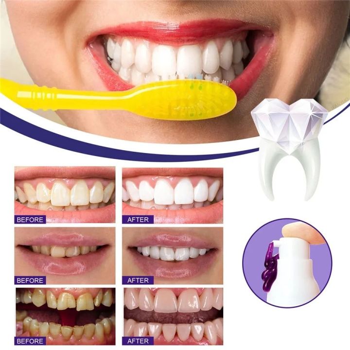 30ml%20V34%20Purple%20Whitening%20Toothpaste%20Removal%20Tooth%20Stains%20Cleaning%20Oral%20Hygiene%20Bleaching%20Dental%20Tools%20Fresh%20Breath%20Tooth%20Care%20-%20Image%208