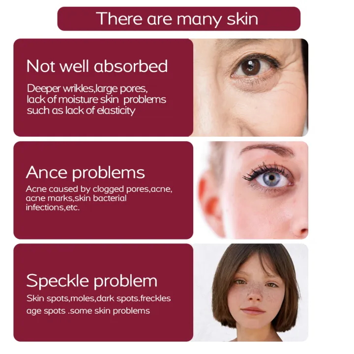 Fibroblast%20Plasma%20Pen%20Eyelid%20Lifting%20Electric%20Dark%20Pigment%20Mole%20Remove%20Spot%20Skin%20Tags%20Beauty%20Medical%20Blackhead%20Removal%20Machine%20-%20Image%205