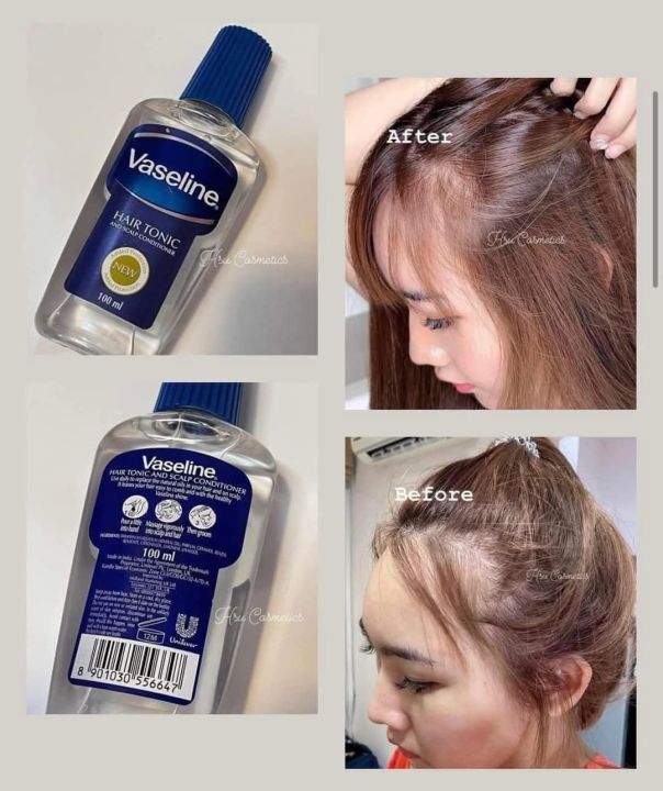 %E2%9C%85Vaseline%20Hair%20Tonic%20And%20Scalp%20Conditioner%20200ml%20-%20Image%205