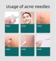 4PCS Blackhead Remover Acne Needle Tools Set Face Cleaning Black Dots Pimple Comedone Extractor Pore Cleaner Skin Care Products. 