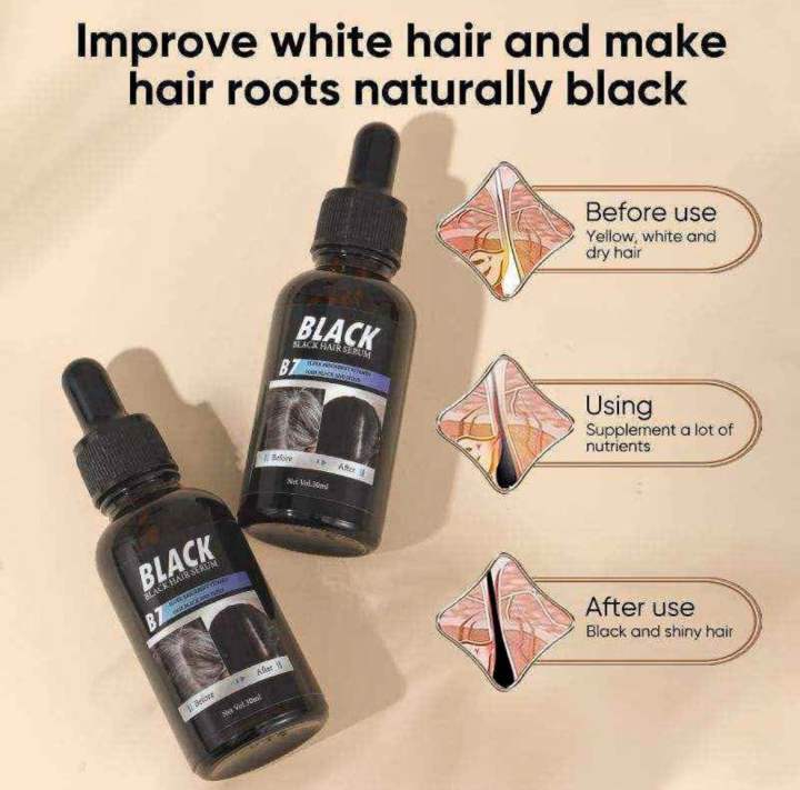 MOIKA%20Black%20Hair%20Essence%20%7C%20Anti-Hair%20Loss,%20Growth%20Booster,%20Revitalize%20with%20Lustrous%20Black%20Shine,%20Professional%20Hair%20Care%2030ml%20-%20Image%205