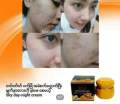 SKY Pearl And Curcumin Whitening Cream 20g. 
