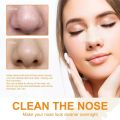 10pcsGentle Cleansing Face Remove Blackhead Acne Nose Strip Remove Grease Peel Clean Blackhead Nose Strip. 