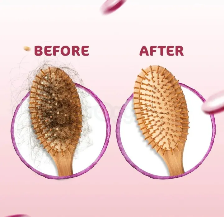 Mamaearth%20Onion%20Shampoo%20For%20Hair%20Fall%20Control%20-%20Image%204