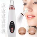 ￼Electric Face Suction Removal Machine Pore Cleaner black Head Vacuum Pimple Black Head Remover ( 5 Suction ). 
