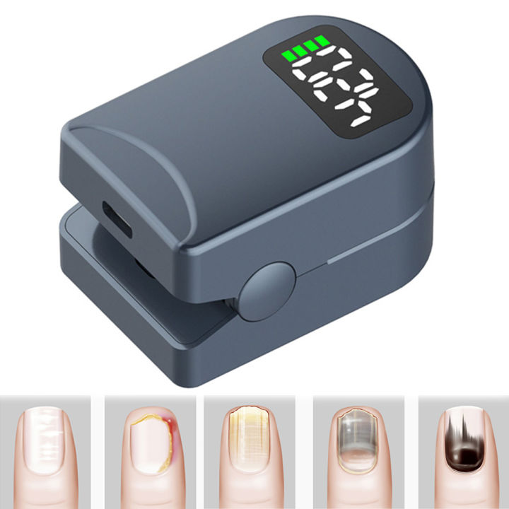 Toenail Machine Nail Fungal Light Device Toenail Fungal Cleaning Machine Portable 460nm ...