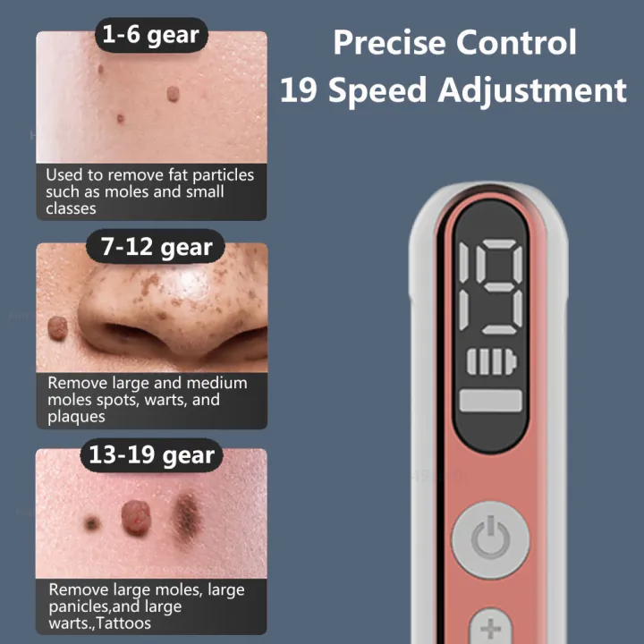 Plasma%20Pen%20Skin%20Tag%20Remover%20Mole%20Removal%20Wart%20Spots%20Dark%20Dpot%20Black%20Dot%20Nevus%20Freckle%20Flat%20Blemish%20Pimples%20Removal%20for%20Face%20Body%20-%20Image%204