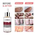 LANBENA Nail Repair Essence - 15ml. 