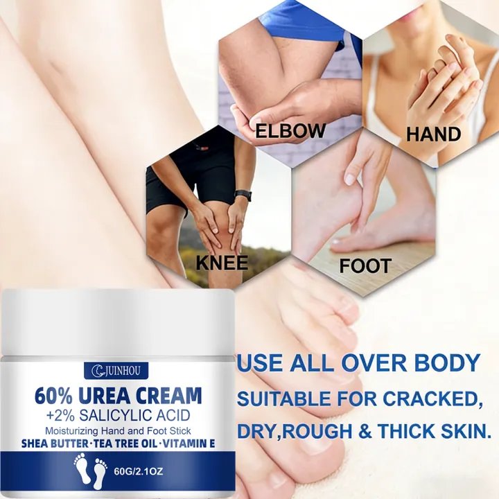 JUINHOU%2060%25Urea%20Foot%20Cream%20for%20Cracked%20Heels%20Dry%20Skin%20Intensive%20Moisturizing%20Treatment%20Callus%20Remover%20Smooth%20Skin%20Daily%20Foot%20Car%20-%20Image%204
