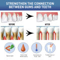 Damaged Gum Repair Care Gel Relieve Sore Gums Allergy Deep Cleaning Teeth Stains Tartar Serum Dental Caries Tootaste 4ml. 