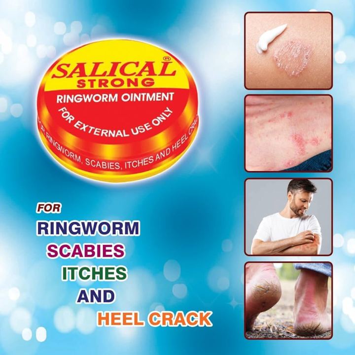 Salical%20Strong%20Ringworm%20Ointment%20Cream%204%20pcs%20%2015g%20(indian)%20-%20Image%203