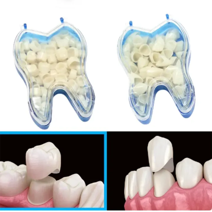 AG%2050%20Pcs/Box%20Dental%20Temporary%20Crown%20Kit%20Anterior%20Front%20Molar%20Posterior%20Teeth%20Veneers%20Dentistry%20Tooth%20%20Dental%20Tools%20-%20Image%204