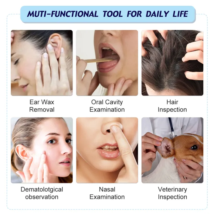 Smart%20Visual%20Medico%20Otoscopio%20Ear%20Cleaner%20Ear%20Endoscope%20Earpick%20Camera%20Ear%20Wax%20Remover%20Tool%20Ear%20Picker%20Ear%20Stick%20beleza%20e%20saude%20-%20Image%206