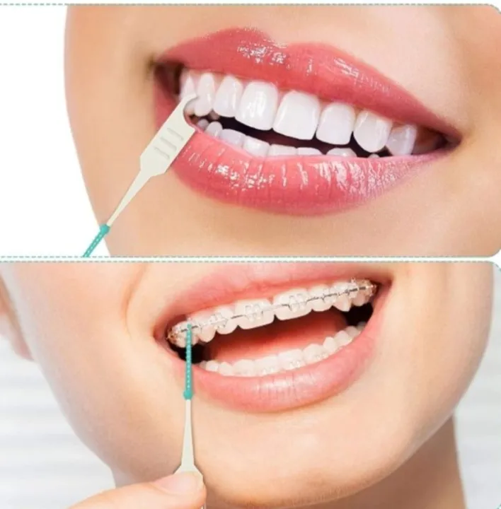 20%20PCs%20Interdental%20Brushes%20Floss%20Sticks%20Compatible%20Soft%20Cleaning%20Tool%20-%20Image%205