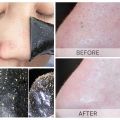 Unisex Blackhead Remove Mask Peel Nasal Strips Deep Shrink Cleansing Pore Nose Black Head Remove Stickers Skin Care Mask Patch. 