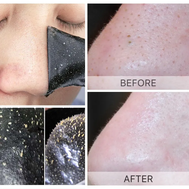 Unisex%20Blackhead%20Remove%20Mask%20Peel%20Nasal%20Strips%20Deep%20Shrink%20Cleansing%20Pore%20Nose%20Black%20Head%20Remove%20Stickers%20Skin%20Care%20Mask%20Patch%20-%20Image%206