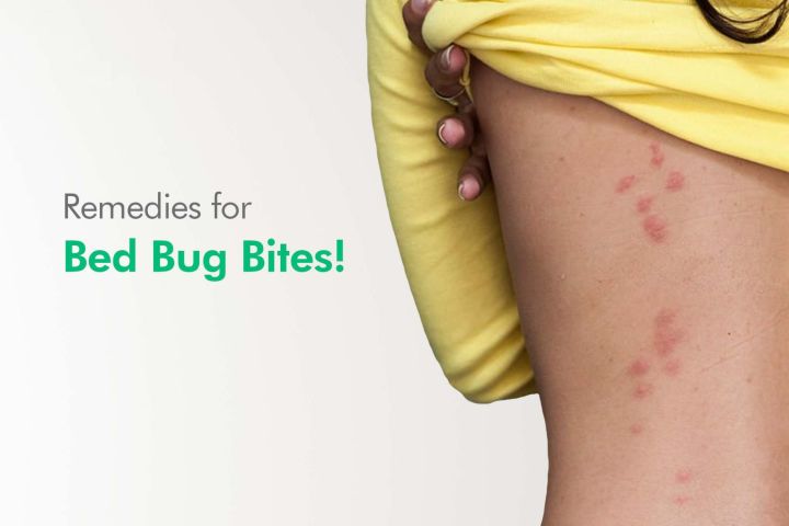 Bed%20Bug%20Treatment%20/%20Pest%20Control%20per%20room%20-%20Image%202