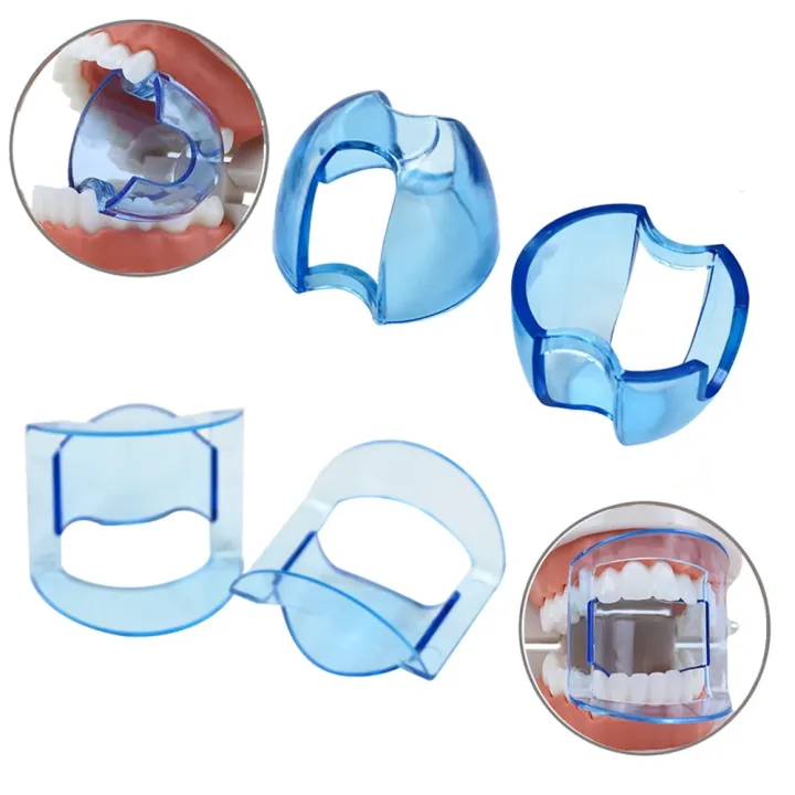 Dental%20Mouth%20Opener%20Intraoral%20Autoclave%20Lip%20Cheek%20Retractor%20For%20Anterior%20Posterior%20Teeth%20Oral%20Hygiene%20Separator%20Orthodontic%20-%20Image%204