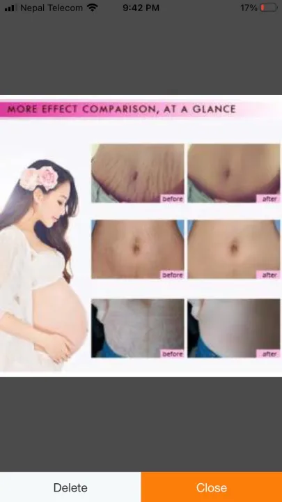 RTOPR%20Mango%20Remove%20Pregnancy%20Scars%20Acne%20Cream%20Stretch%20Marks%20Treatment%20Maternity%20Repair%20Anti-Aging%20Anti%20Winkle%20Firming%20Body%20Cream-40g%20-%20Image%205