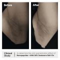 Minimalist Nonapeptide + AHA 06% Underarm Roll On For Odour Free and Even Skin Tone 40 ml. 