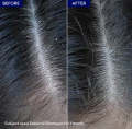 Sebornil Shampoo
Stops Dandruff | Relieves Itching. 
