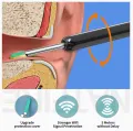 Visual Ear Cleaner Earpick Camera Earwax Removal Kit Otoscope USB C Charging Endoscope Ear Cleaning camera.