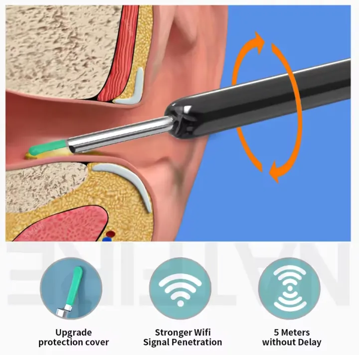 Visual%20Ear%20Cleaner%20Earpick%20%20Camera%20Earwax%20Removal%20Kit%20Otoscope%20USB%20C%20Charging%20Endoscope%20Ear%20Cleaning%20camera%20-%20Image%205