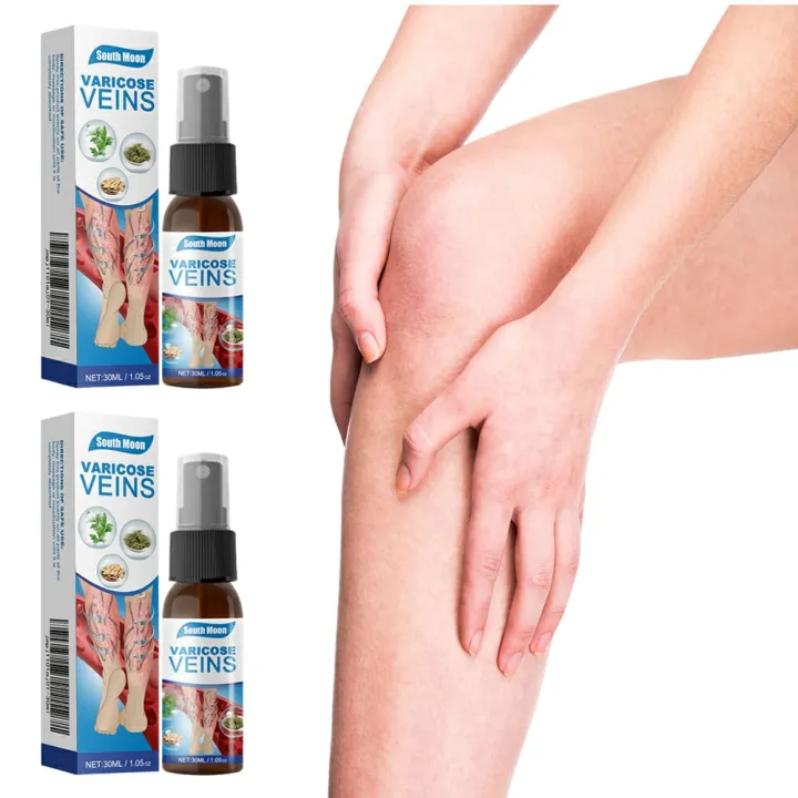 South%20Moon%20Varicose%20Veins%20Treatment%20Spray%20%7C%20Advanced%20Solution%20for%20Spider%20Veins,%20Leg%20Pain%20&%20Swelling%20Relief%20-%20Image%205