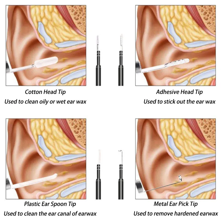 Smart%20Visual%20Medico%20Otoscopio%20Ear%20Cleaner%20Ear%20Endoscope%20Earpick%20Camera%20Ear%20Wax%20Remover%20Tool%20Ear%20Picker%20Ear%20Stick%20beleza%20e%20saude%20-%20Image%205