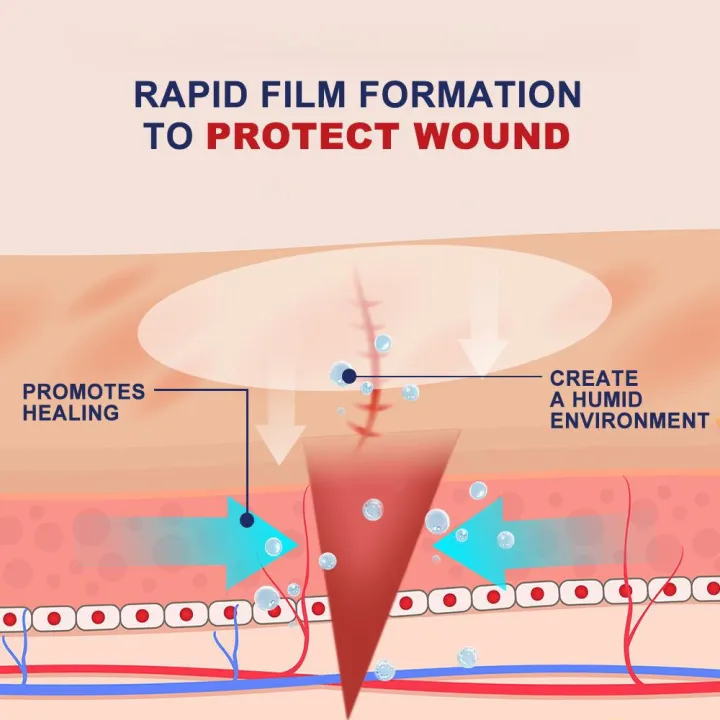 Rapid%20Hemostasis%20Wound%20Spray%20Instant%20Scab%20Formation%20Waterproof%20Antibacterial%20Protective%20Film%20Non%20Irritating%20Formula%20for%20Adults%20-%20Image%206
