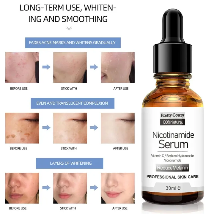 Pretty%20Cowry%20Nicotinamide%20Serum%20100%25%20Natural%20%7CFor%20all%20Skin%20Type%7C%2030%20mL%20%7C%20-%20Image%203
