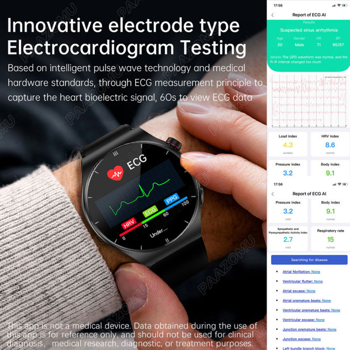 2026%20New%20AI%20Diagnostic%20Detector%20Smart%20Watch%20Women%20Blood%20Lipid%20and%20Uric%20Acid%20Body%20Composition%20Test%20Women%20Menstrual%20Health%20Tracker%20-%20Image%204
