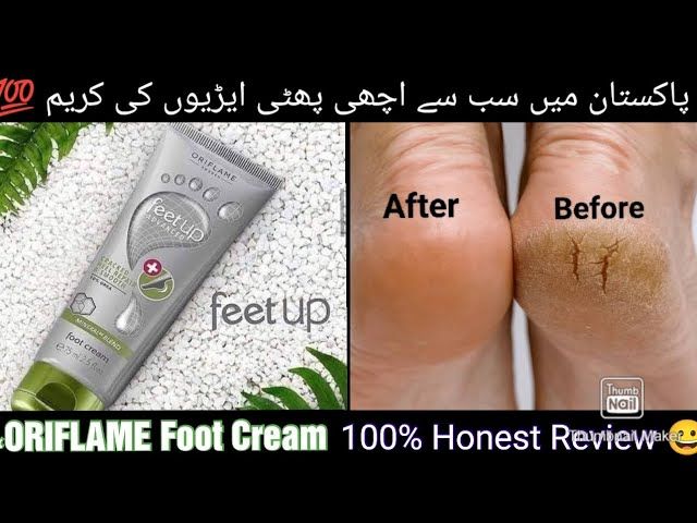 "Feet%20Up%20Advanced%20Cracked%20Heel%20Repair%20Cream%20by%20Oriflame"%20-%20Image%204