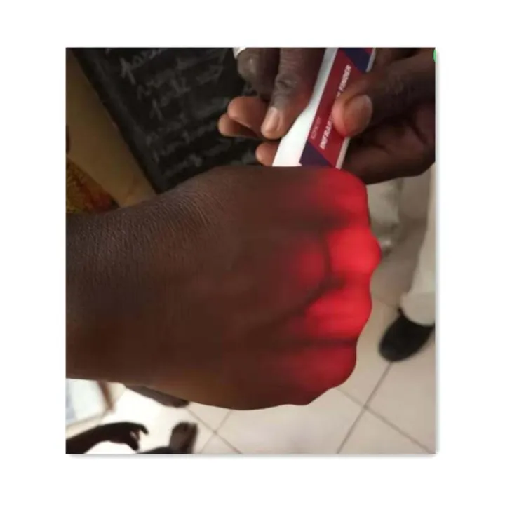 JUSTLANG%20Medical%20Infrared%20Vein%20Viewer%20Transilluminator%20LED%20Vessel%20Vein%20Instrument%20Vessel%20Finder%20Infrared%20Blood%20Vessel%20Lamp%20-%20Image%204