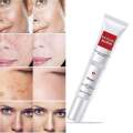 YOUBUY Whitening and Freckle Removing Cream 20 gm. 