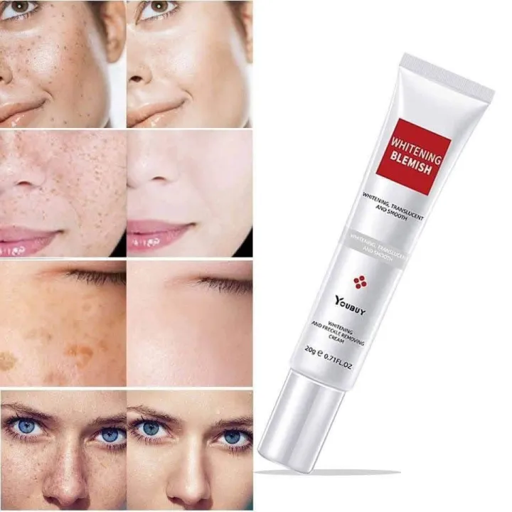 YOUBUY%20Whitening%20and%20Freckle%20Removing%20Cream%2020%20gm%20-%20Image%202