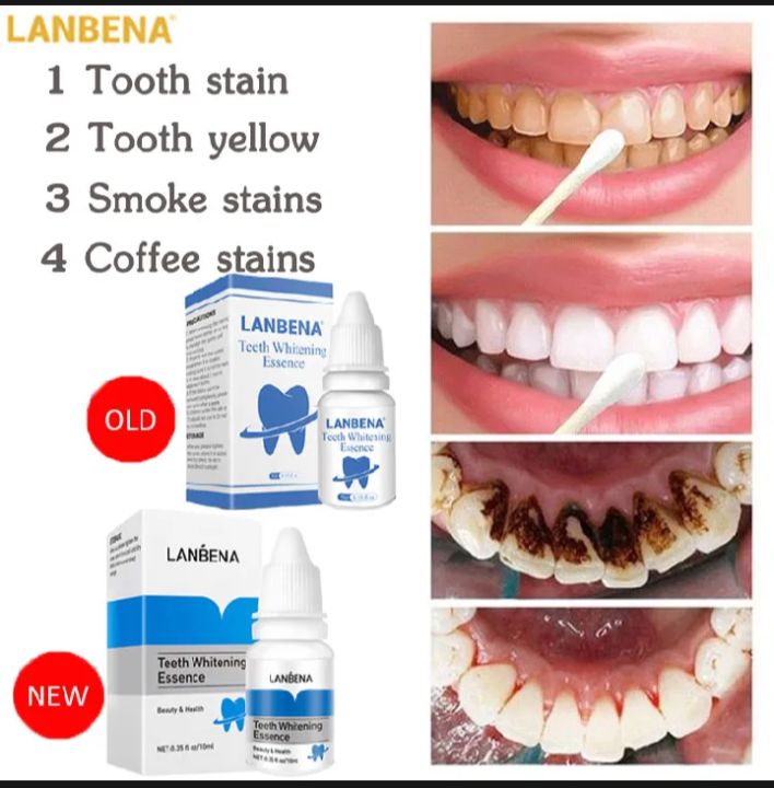 LANBENA%20%20Teeth%20%20whitening%20essence(%E0%A6%A6%E0%A6%BE%E0%A6%A4%20%E0%A6%B8%E0%A6%BE%E0%A6%A6%E0%A6%BE%20%E0%A6%95%E0%A6%B0%E0%A6%AC%E0%A7%87)%20%20original%20ptoduct%2010%20ml.%20-%20Image%202