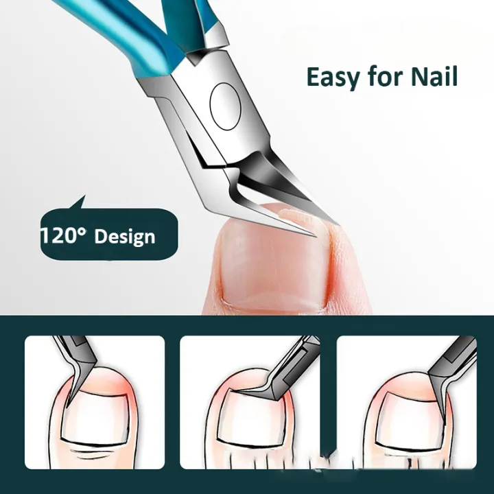 Culticle%20Nipper%20Nail%20Clipper%20Ingrown%20Thick%20Toenails%20Trimmer%20Professional%20Podiatrist%20Toenail%20Nipper%20With%20Stainless%20Steel%20-%20Image%202