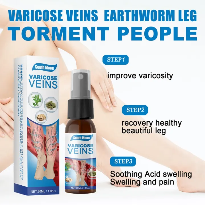 South%20Moon%20Varicose%20Veins%20Treatment%20Spray%20%7C%20Advanced%20Solution%20for%20Spider%20Veins,%20Leg%20Pain%20&%20Swelling%20Relief%20-%20Image%203