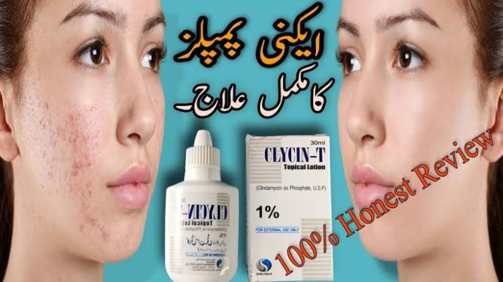 Clycin-T%20Lotion%2030ml%20-%20Image%202