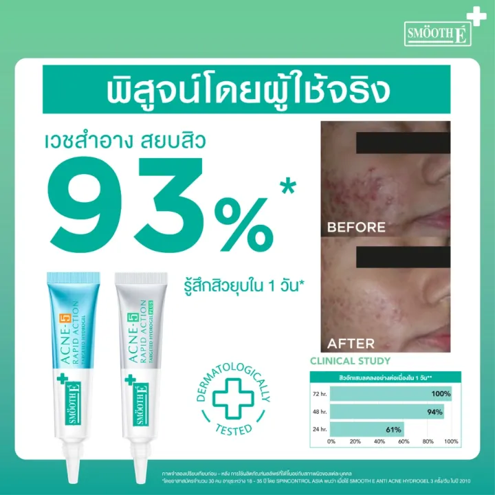 Smooth%20E%20acne%205%20Rapid%20Action%20anti%20acne%20hydrogel%20smooth%20e%20acne%205%20Rapid%20Action%20anti%20acne%20hydrogel%20%5B7G%5D%20anti-Acne%20Gel%20-%20Image%208