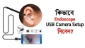 This Earwax Removal Camera Is Equal Parts Satisfying And Disgusting.