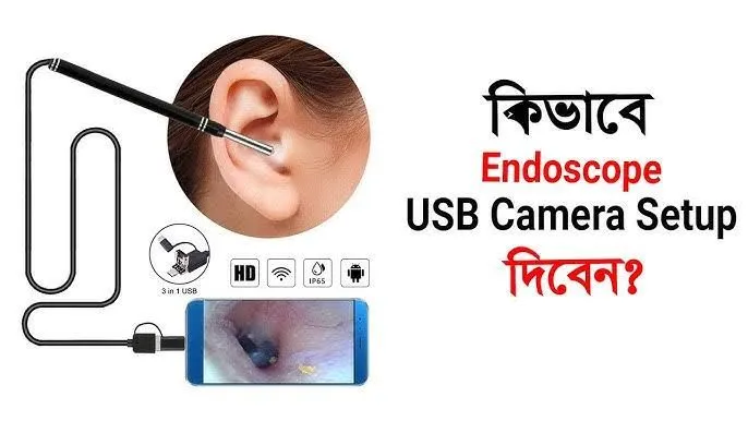 This%20Earwax%20Removal%20Camera%20Is%20Equal%20Parts%20Satisfying%20And%20Disgusting%20-%20Image%207