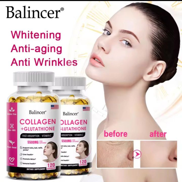 30%20pcs%20Glutathione%20&%20Collagen%20Capsules%20for%20skin%20whitening%205500mg%20for%20healthy%20skin,%20hair%20&%20nails.%20Supplement%20with%20Collagen%20powerful%20Antioxidant,%20Anti-aging,%20Improve%20Color%20&%20smooth%20skin.%20%E0%A6%AB%E0%A6%B0%E0%A7%8D%E0%A6%B8%E0%A6%BE%20%E0%A6%8F%E0%A6%AC%E0%A6%82%20%E0%A6%B8%E0%A7%81%E0%A6%A8%E0%A7%8D%E0%A6%A6%E0%A6%B0%20%E0%A6%B8%E0%A7%8D%E0%A6%95%E0%A6%BF%E0%A6%A8%E0%A7%87%E0%A6%B0%20%E0%A6%9C%E0%A6%A8%E0%A7%8D%E0%A6%AF%20%F0%9F%98%8A%20-%20Image%209
