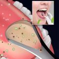 1/2/3Pcs Reusable Stainless Steel Useful Tongue Scraper Cleaner Fresh Breath Cleaning Coated Tongue Oral Hygiene Care Tools.